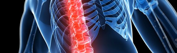 How Does Acquiescence Ruling (AR) 15-1(4) Apply to Disorders of the Spine?