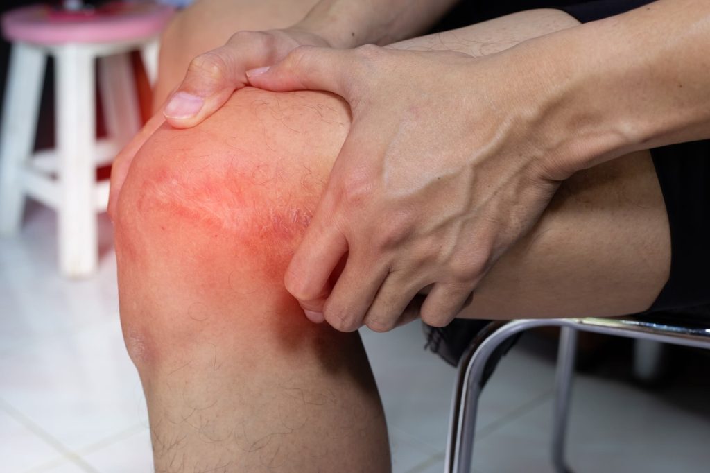 Chronic Pain and Disability Benefits: How to Prove an Invisible Condition